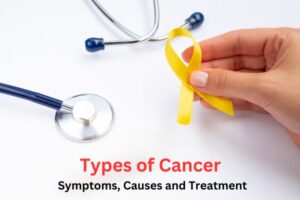 Types of Cancer Symptoms, Causes and Treatment