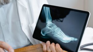top orthopedic hospital in hyderabad