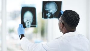 best neuro care hospital hyderabad