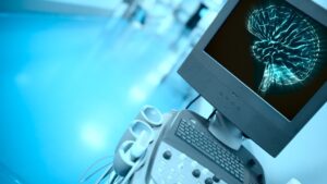 top neuro hospital in hyderabad