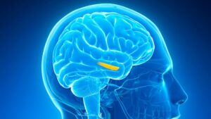 Advanced neuro hospital Hyderabad
