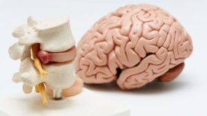Leading brain and spine hospital Hyderabad