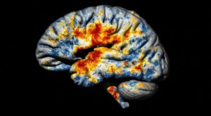 Professional neuro physician in Hyderabad
