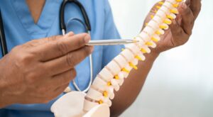 Affordable spine surgeon in Hyderabad