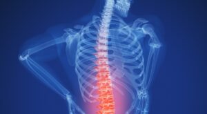 Caring back pain treatment in Hyderabad
