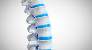Preferred best hospitals in Hyderabad for back pain