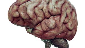 Specialized Neuro Care