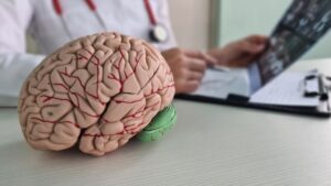 best hospital for neurology in hyderabad