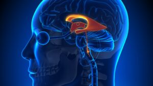best brain stroke treatment in hyderabad