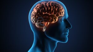 famous hospital for brain stroke treatment in hyderabad