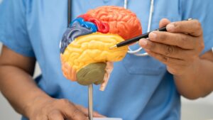 advanced brain stroke treatment in hyderabad