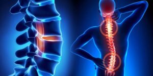 Neuro Spine Hospital