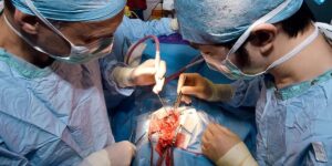 Brain Tumor Surgery