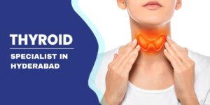 Thyroid Specialist in Hyderabad?