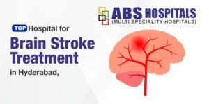 Top Hospital for Brain Stroke Treatment in Hyderabad