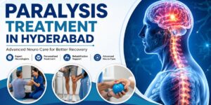 Paralysis Treatment in Hyderabad