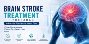 Brain Stroke Treatment Hyderabad